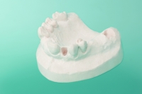 Model kości szczęki z zębami 10-5020