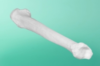 kość piszczelowa lewa bez kanału 20-1900