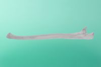 kość łokciowa 10-1100