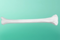 Kość piszczelowa prawa 20-2001