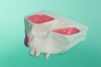 Szczęka  ze śluzówką wyścielającą zatokę szczękową 10-5001