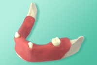 Żuchwa do fantomów z wyrostkiem zębodołowym wyścielonym imitacją błony śluzowej oraz zębami 10-3040