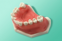 Model szczęki przeznaczony do szkoleń z zastosowania miniimplantów 10-3150