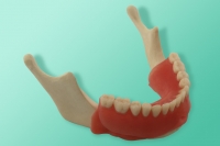 Model żuchwy bezzębnej z protezą 10-1102